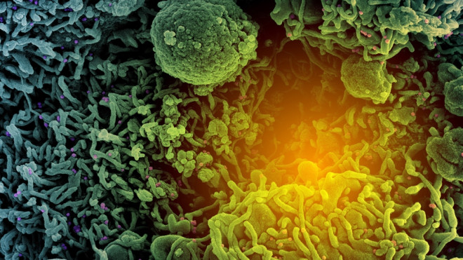 Omicron subvariants BA.4 and BA.5 appear to escape antibody responses among both people who had previous COVID-19 infection and those who have been fully vaccinated and boosted, according to new data. (NIAID/NIH/CNN)